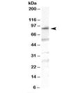 Western blot testing of human duodenum lysate with OSBPL10 antibody at 1ug/ml. Predicted molecular weight: ~84kDa.