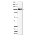 Western blot testing of mouse lung tissue lysate with Thbd antibody. Expected molecular weight ~60/100 kDa (unmodified/glycosylated).
