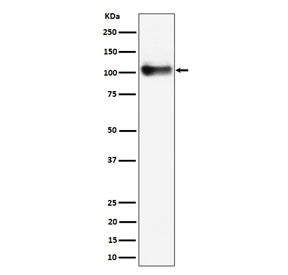 Western blot testing of mouse lung tissue lysate with Thbd antibody. Expected molecular weight ~60/100 kDa (unmodified/glycosylated).