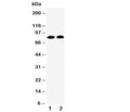 Western blot testing of Calpain 1 antibody and Lane 1: HT1080; 2: COLO320 cell lysate. Predicted molecular weight: ~82kDa.