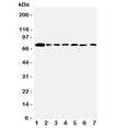Western blot testing of SPARCL1 antibody and Lane 1: rat lung; 2: mouse lung; and human samples 3: PANC; 4: A549; 5: COLO320; 6: MCF-7; 7: HT1080 cell lysate. Predicted/observed molecular weight ~75 kDa.