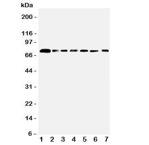 Western blot testing of SPARCL1 antibody and Lane 1: rat lung; 2: mouse lung; and human samples 3: PANC; 4: A549; 5: COLO320; 6: MCF-7; 7: HT1080 cell lysate. Predicted/observed molecular weight ~75 kDa.