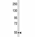 PCSK4 antibody western blot analysis in SK-BR-3 lysate.