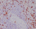 IHC staining of FFPE human spleen tissue with CD11b antibody. HIER: boil tissue sections in pH6, 10mM citrate buffer, for 10-20 min followed by cooling at RT for 20 min.