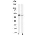 Western blot testing of human 1) lymph node and 2) tonsil tissue lysate with LAG3 antibody at 1ug/ml and 0.5ug/ml, respectively. Predicted molecular weight ~54 kDa.