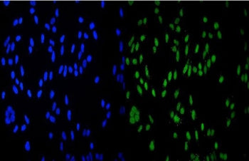 Immunofluorescent staining of FFPE human HeLa cells with HDAC9 antibody (green) and DAPI nuclear stain (blue). HIER: steam section in pH6 citrate buffer for 20 min.