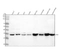 Western blot analysis of LIMS1 using anti-LIMS1 antibody. Lane 1: human Caco-2 whole cell lysates, Lane 2: human Hela whole cell lysates, Lane 3: human 293T whole cell lysates, Lane 4: human Jurkat whole cell lysates, Lane 5: rat lung tissue lysates, Lane 6: rat kidney tissue lysates, Lane 7: mouse lung tissue lysates, Lane 8: mouse kidney tissue lysates. After electrophoresis, proteins were transferred to a nitrocellulose membrane at 150 mA for 50-90 min.