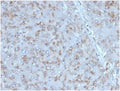 IHC staining of FFPE human adrenal gland tissue with Interleukin 15 antibody (clone IL15/4353). HIER: boil tissue sections in pH 9 10mM Tris with 1mM EDTA for 20 min and allow to cool before testing.