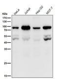 Western blot testing of human samples using the PSIP1 antibody at 1:1000 dilution for 1 hour at room temperature. A doublet is observed at ~50-55 kDa corresponding to the unmodified p75 and p52 isoforms, with an additional band at ~80â€“90 kDa representing post-translationally modified or complexed PSIP1 forms described in the literature.