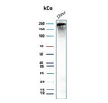 Western blot testing of human liver tissue lysate with CPS1 antibody (clone CPS1/9868). Predicted molecular weight ~165 kDa but may be observed at higher molecular weights due to glycosylation.