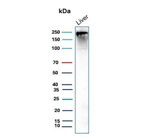 Western blot testing of human liver tissue lysate with CPS1 antibody (clone CPS1/9868). Predicted molecular weight ~165 kDa but may be observed at higher molecular weights due to glycosylation.