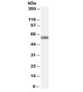 Western blot testing of human peripheral blood mononucleocyte lysate with GNRHR antibody at 0.5ug/ml. Expected molecular weight: 38-60 kDa but may be observed at higher molecular weights due to glycosylation.