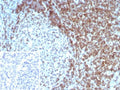 IHC staining of FFPE human tonsil tissue with CD3 delta antibody (clone CD3D/8898). Inset: PBS used in place of primary Ab (secondary Ab negative control). HIER: boil tissue sections in pH 9 10mM Tris with 1mM EDTA for 20 min and allow to cool before testing.