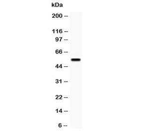 Western blot testing of TFPI antibody and SMMC-7721 lysate; Predicted/observed molecular weight: 35/40-50kDa.