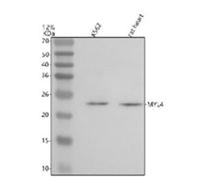 Western blot analysis of MYL4 using anti-MYL4 antibody. Lane 1: mouse heart tissue lysates. After electrophoresis, proteins were transferred to a nitrocellulose membrane at 150 mA for 50-90 min. Blocked the membrane with 5% non-fat milk/TBS for 1.5 hour at RT. The membrane was incubated with rabbit anti-MYL4 antibody at 0.5 ug/ml overnight at 4oC, then washed with TBS-0.1%Tween 3 times with 5 min each and probed with a goat anti-rabbit IgG-HRP secondary antibody at a dilution of 1:5000 for 1.5 hour at RT.