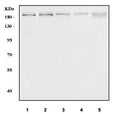 Western blot testing of 1) human K562, 2) human MCF7, 3) rat testis, 4) rat C6 and 5) mouse testis tissue lysate with PCF11 antibody. Predicted molecular weight ~173 kDa.