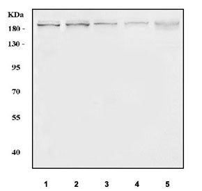 Western blot testing of 1) human K562, 2) human MCF7, 3) rat testis, 4) rat C6 and 5) mouse testis tissue lysate with PCF11 antibody. Predicted molecular weight ~173 kDa.