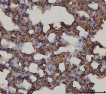 IHC staining of FFPE mouse lung tissue with AGER antibody. HIER: boil tissue sections in pH8 EDTA for 20 min and allow to cool before testing.