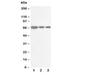 Western blot testing of CDC25B antibody and Lane 1: rat brain; 2: rat kidney; 3: rat lung tissue lysate. Expected/observed molecular weight: 61~67kDa (isoforms 1-4).