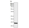Western blot testing of human U-87 MG with CSTB antibody. Predicted molecular weight ~11 kDa.