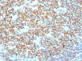 IHC testing of recombinant CD20 antibody and FFPE human tonsil tissue. Required HIER: steam section in pH 9 10mM Tris with 1mM EDTA for 20 min.