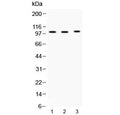 Western blot testing of 1) rat testis, 2) mouse testis and 3) MCF7 lysate with ADAM2 antibody at 0.5ug/ml. Predicted molecular weight ~82 kDa, but can be observed at ~100 kDa.