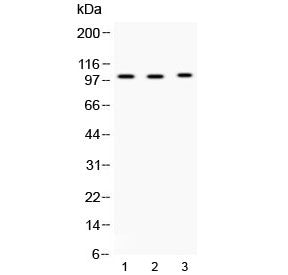 Western blot testing of 1) rat testis, 2) mouse testis and 3) MCF7 lysate with ADAM2 antibody at 0.5ug/ml. Predicted molecular weight ~82 kDa, but can be observed at ~100 kDa.