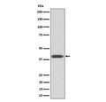 Western blot analysis of extracts from human HeLa cells, using Phospho-PKA C (Thr197) antibody. The predicted molecular weight of P-PRKA/C/G is ~40 kDa.