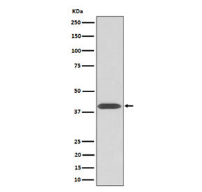 Western blot analysis of extracts from human HeLa cells, using Phospho-PKA C (Thr197) antibody. The predicted molecular weight of P-PRKA/C/G is ~40 kDa.