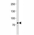 Western blot analysis of lysate from HeLa cell line using anti-PCSK9 antibody at 1:1000. Predicted size: Pro/mature ~74/64 kDa
