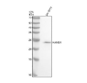 Western blot analysis of HAND1 using anti-HAND1 antibody. Electrophoresis was performed on a 12% SDS-PAGE gel at 80V (Stacking gel) / 120V (Resolving gel) for 2 hours. Lane 1: human SH-SY5Y whole cell lysates. After electrophoresis, proteins were transferred to a nitrocellulose membrane at 150 mA for 50-90 min. Blocked the membrane with 5% non-fat milk/TBS for 1.5 hour at RT.