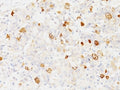 IHC: Formalin-fixed, paraffin-embedded human pituitary stained with FSH-beta antibody (clone SPM107).