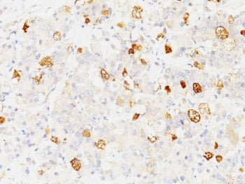 IHC: Formalin-fixed, paraffin-embedded human pituitary stained with FSH-beta antibody (clone SPM107).