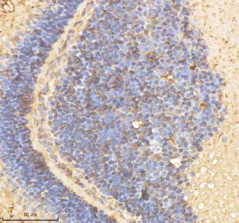 IHC staining of FFPE zebrafish eye tissue with Psmd2 antibody, HRP-labeled secondary and DAB substrate. HIER: boil tissue sections in pH8 EDTA for 20 min and allow to cool before testing.