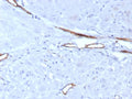 IHC staining of FFPE human uterus tissue with vWF antibody (clone VWF/7979R). HIER: boil tissue sections in pH 9 10mM Tris with 1mM EDTA for 20 min and allow to cool before testing.