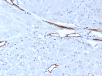 IHC staining of FFPE human uterus tissue with vWF antibody (clone VWF/7979R). HIER: boil tissue sections in pH 9 10mM Tris with 1mM EDTA for 20 min and allow to cool before testing.