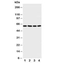 Western blot testing of RIP2 antibody and Lane 1: A549; 2: HeLa; 3: PANC; 4: COLO320 cell lysate. Predicted molecular weight: ~61 kDa.