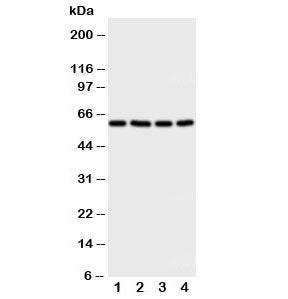 Western blot testing of RIP2 antibody and Lane 1: A549; 2: HeLa; 3: PANC; 4: COLO320 cell lysate. Predicted molecular weight: ~61 kDa.