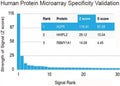 Analysis of HuProt(TM) microarray containing more than 19,000 full-length human proteins using BRCA-1 antibody (clone BRCA1/2973). These results demonstrate the foremost specificity of the BRCA1/2973 mAb. Z- and S- Score: The Z-score represents the strength of a signal that a monoclonal antibody (clone MAb) (in combination with a fluorescently-tagged anti-IgG secondary antibody) produces when binding to a particular protein on the HuProt(TM) array.