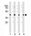 Western blot analysis of lysate from (1) HeLa, (2) U-87 MG, (3) rat C6 cell line and (4) mouse heart tissue lysate using Connexin 43 antibody at 1:1000. Predicted molecular weight: 43 kDa