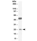 Western blot testing of mouse brain lysate with Neurturin antibody at 0.1ug/ml. The expected ~23kDa band and the additional ~50kDa band are both blocked by the immunizing peptide.