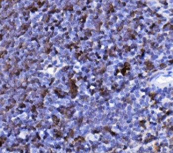 IHC staining of FFPE mouse spleen tissue with Cd20 antibody. HIER: boil tissue sections in pH8 EDTA for 20 min and allow to cool before testing.