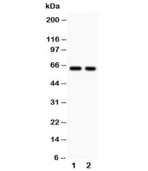 Western blot testing of TGFBR2 antibody and Lane 1: HEPG2; 2: COLO320. Expected molecular weight ~65 kDa, routinely observed at 65-80 kDa.