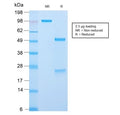 SDS-PAGE analysis of purified, BSA-free recombinant CLIP antibody (clone CLIP/2859R) as confirmation of integrity and purity.