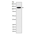 Western blot testing of human fetal kidney lysate with Cadherin 16 antibody. Expected molecular weight: 90-130 kDa.