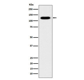 Western blot testing of human fetal kidney lysate with Cadherin 16 antibody. Expected molecular weight: 90-130 kDa.