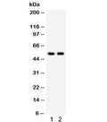 Western blot testing of 1) human HeLa and 2) mouse HEPA lysate with ATG13 antibody. Predicted/observed molecular weight ~57 kDa.