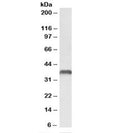 Western blot testing of U937 lysate with CLL-1 antibody at 0.3ug/ml. Predicted molecular weight: ~31/37kDa (unmodified/glycosylated).