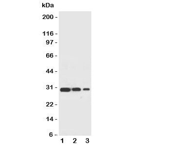 Western blot testing of TRAF2 antbody and recombinant human protein, 30.4KD with tag; Lane 1: 10ng; 2: 5ng; 3: 2.5ng