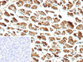 IHC staining of FFPE human pancreas tissue with recombinant CPA1 antibody (clone CPA1/9622R). Inset: PBS used in place of primary Ab (secondary Ab negative control). HIER: boil tissue sections in pH 9 10mM Tris with 1mM EDTA for 20 min and allow to cool before testing.